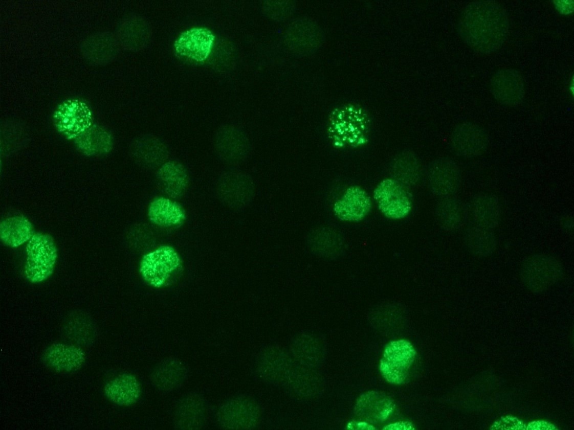 Figure 2: Indirect immunofluorescence staining of BrdU-labeled MR65 lung cancer cells using MUB0200 (IIB5)